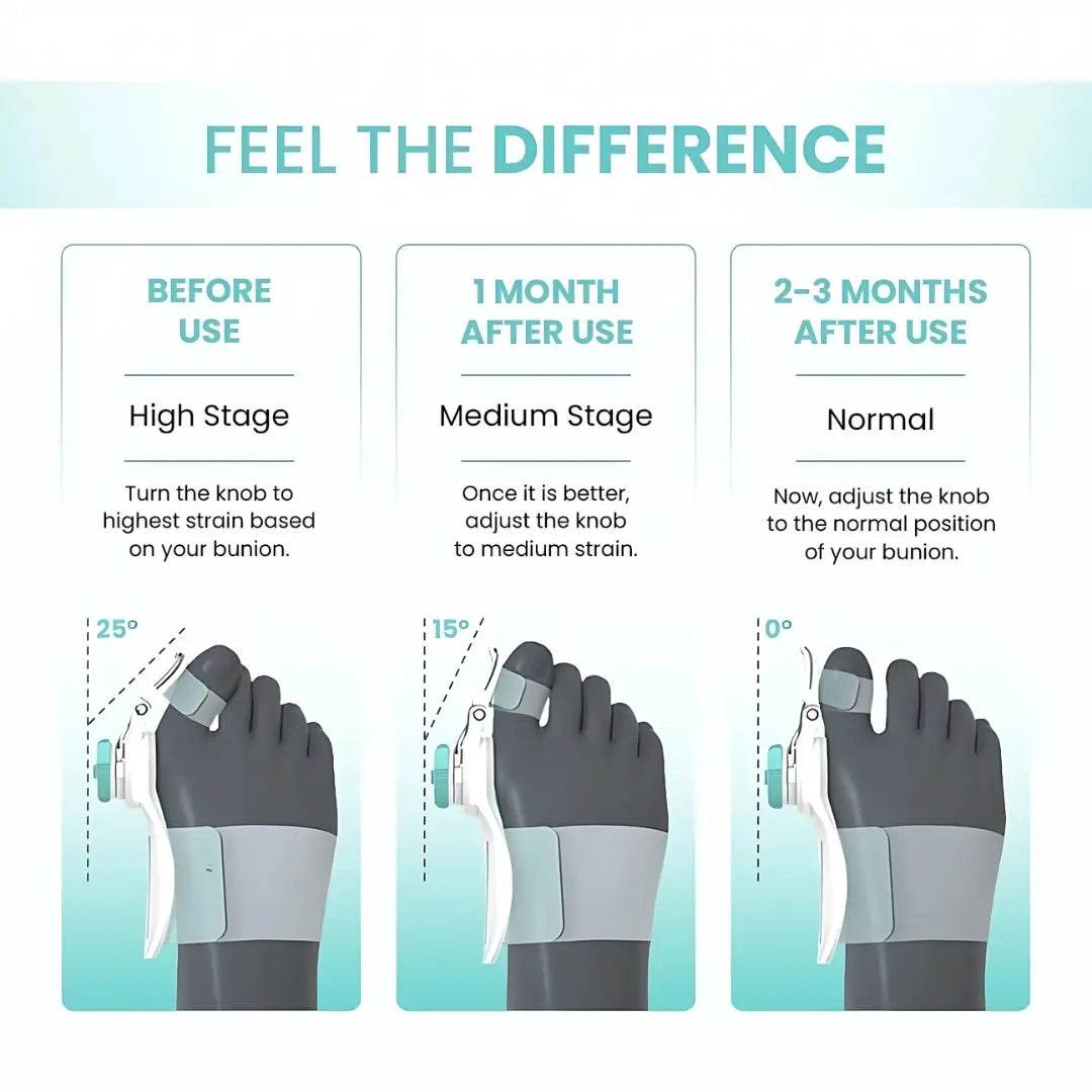 Bunion Splint Pad,Toe Straightener Bunion Corrector - ZenGoods