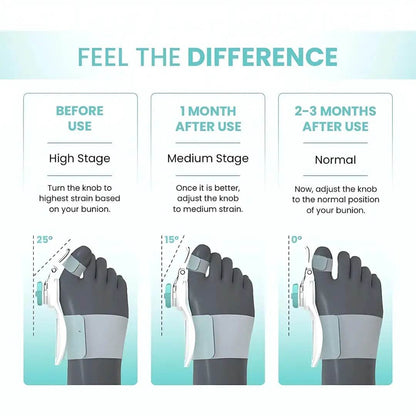 Bunion Splint Pad,Toe Straightener Bunion Corrector - ZenGoods